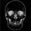 Skulls 13