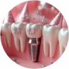 Dental🦷💞1🇵🇪Clásica 8