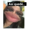 Así quedé..