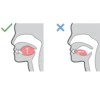 MEWING 6