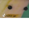 موز شاشدار
