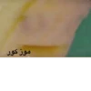 موز کور
