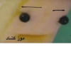 موز گشاد