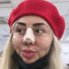 New Nose