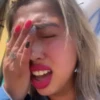 Facepalm