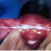 LOL 9