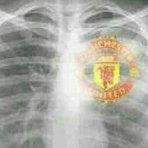 King emyu Manchster United  13