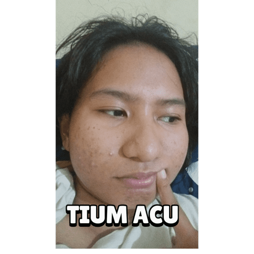 Bubub acu 5