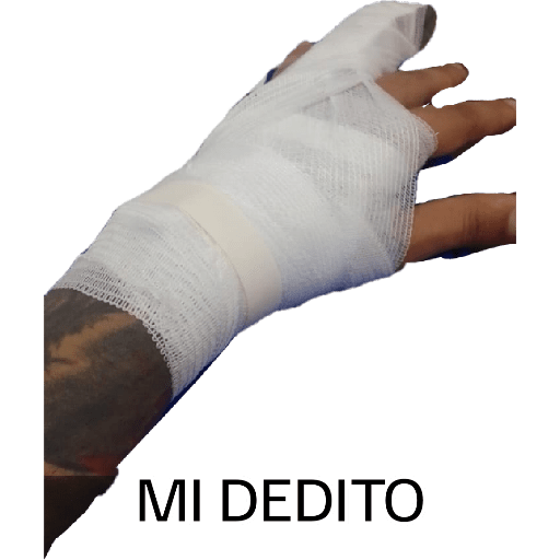 Dilan 14