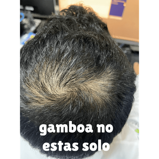 Stickers xd 2