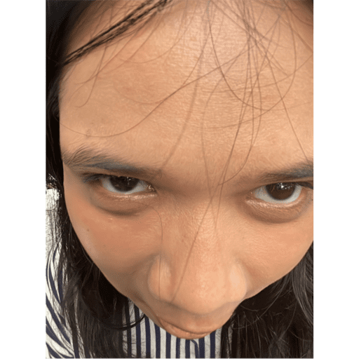 Anomali 14