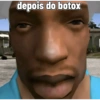 depois do botox