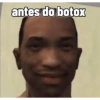 antes do botox