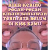 BIBIR KERING ресан-ресан KIRAIN sariawan TERNYATA BELUM DI KISS KAMU