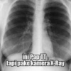 ini Pap TT,
tapi pake kamera X-Ray
